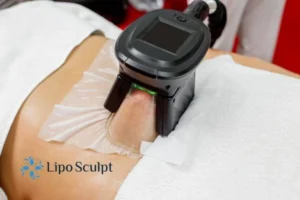 Are The Results From Aqualyx Permanent? 4 Compare Aqualyx Woburn to other fat reduction treatments.