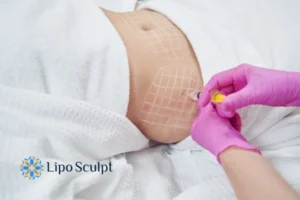 Are The Results From Aqualyx Permanent? 1 Do you want to know how long Aqualyx Woburn results last?