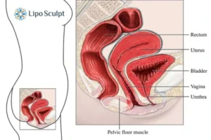 Treatment For A Leaky Bladder 2 How EM Chair treatment Woburn can help Leaky bladder issues. Read more now!
