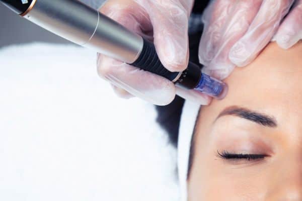 Explaining Total Skin Tightening Treatment and What to Expect 2 What Skin Concerns Can Total Skin Tightening Treatment Help With Woburn?
